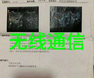 嵌入式开发系统我是如何用一台小巧的硬件和一段简短的代码打造出一个智能家居系统的